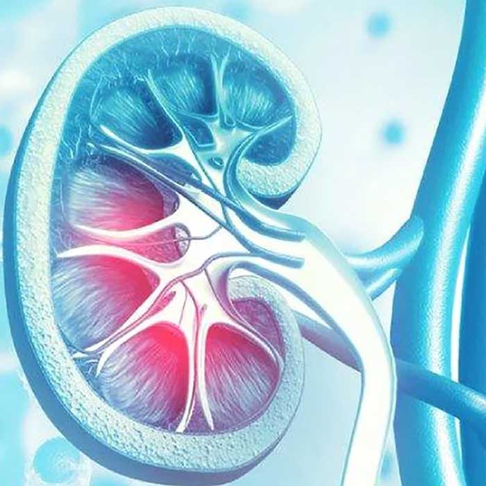 Chronic-Kidney-Disease